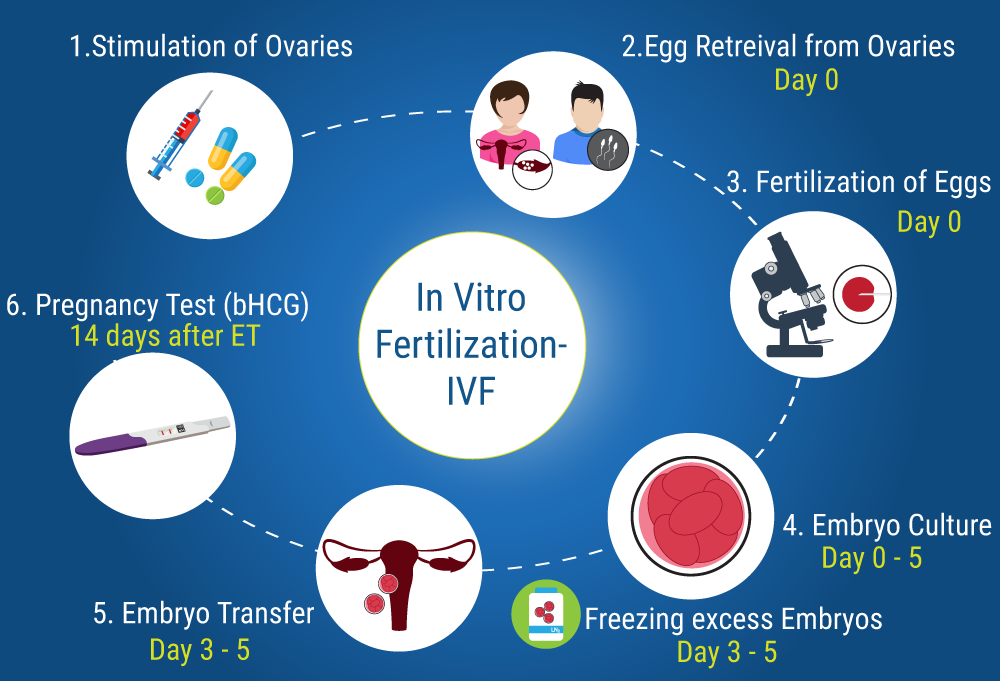 IVF Process followed by the IVF Center in Jaipur