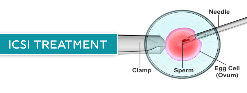 IVF ICSI Treatment for Infertility-Aastha fertility care