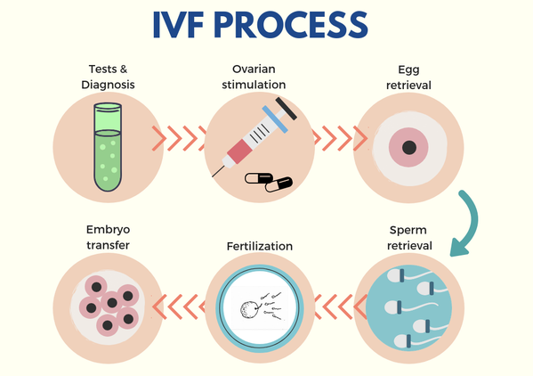 IVF Treatment process | Low IVF cost in Jaipur at Mishka IVF