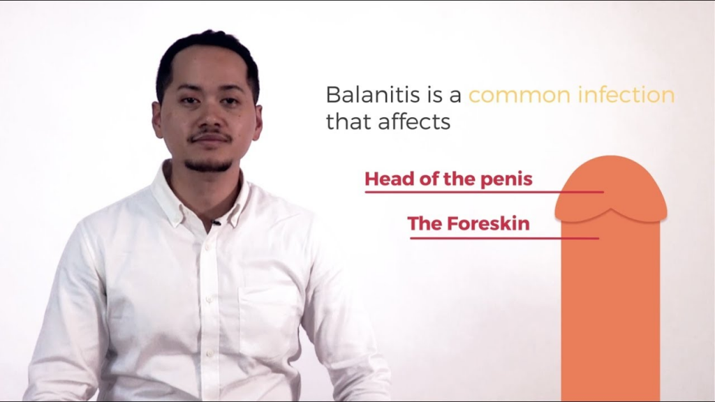 foreskin infection - Balanitis  