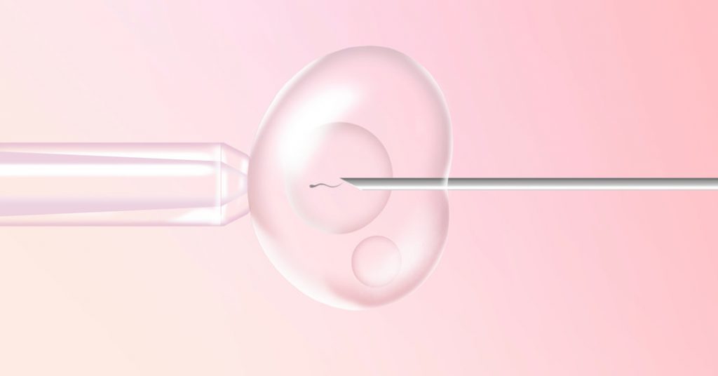 What-Is-ivf-image